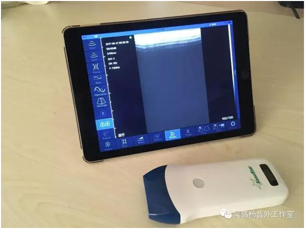 逆天了,这位外科医生配有“透视眼”!