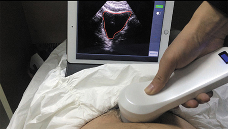 Application of Bladder Scanner