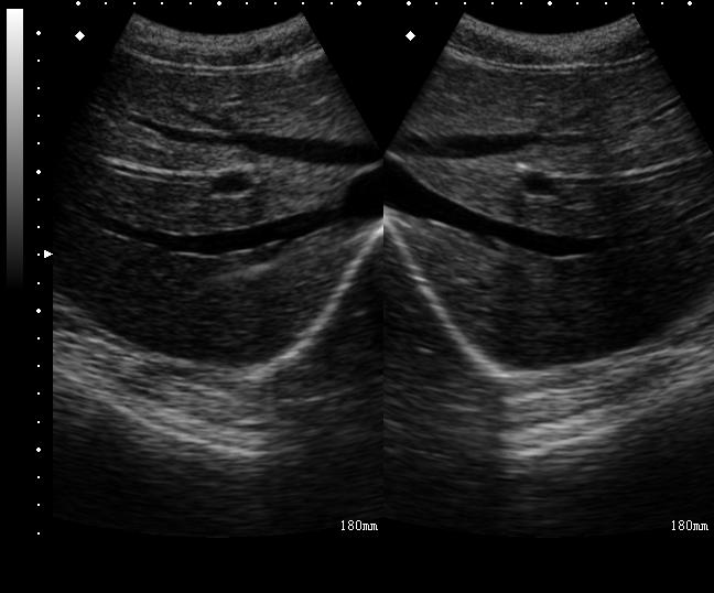 超声显像诊断仪的分类及介绍