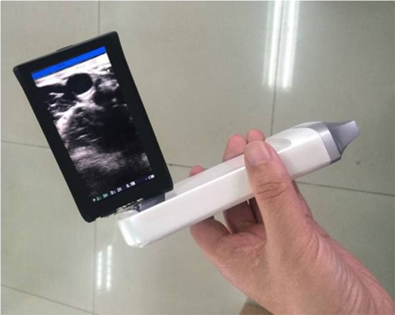 这个新生代掌上B超仪器是如何颠覆传统产品的!