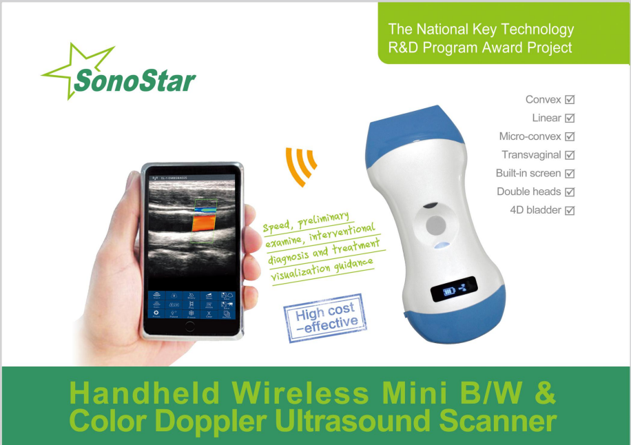 Wireless Probe Type Ultrasound Scanner catalog