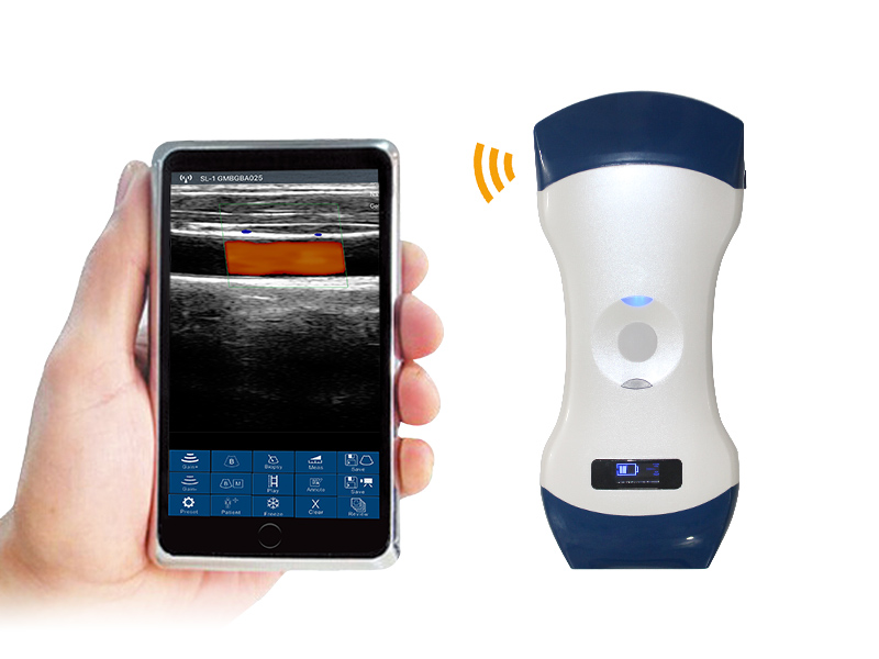 5CL 2in1 palm doppler ultrasound scanner
