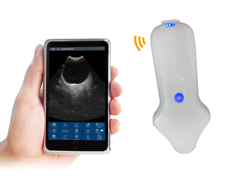 4M micro-convex palm doppler ultrasound scanner