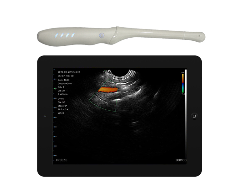 4T transvaginal palm doppler ultrasound scanner