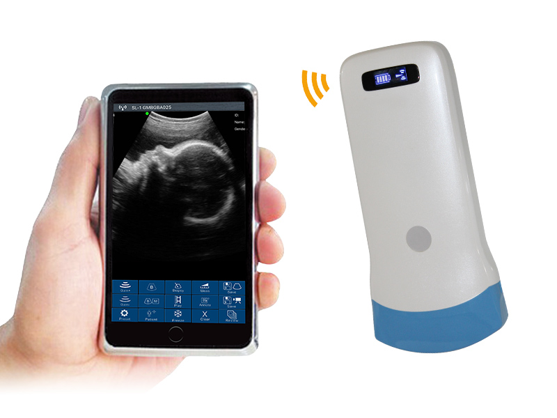 5C convex palm B/W ultrasound scanner