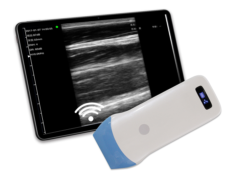 5L linear palm B/W ultrasound scanner