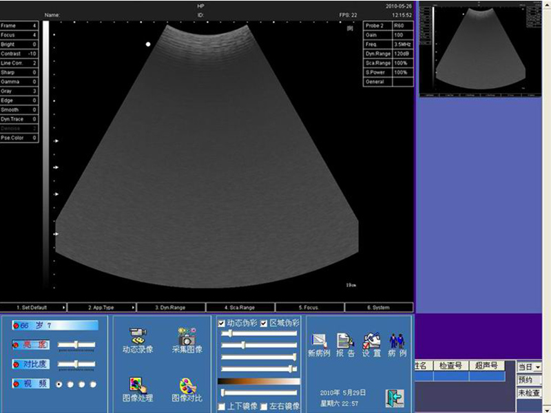 SW-20 超声工作站