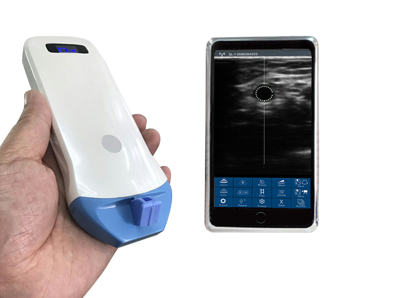 5P linear UHF palm B/W ultrasound scanner