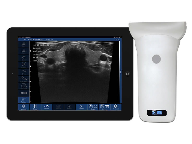 5W ultra-wide linear palm doppler ultrasound scanner