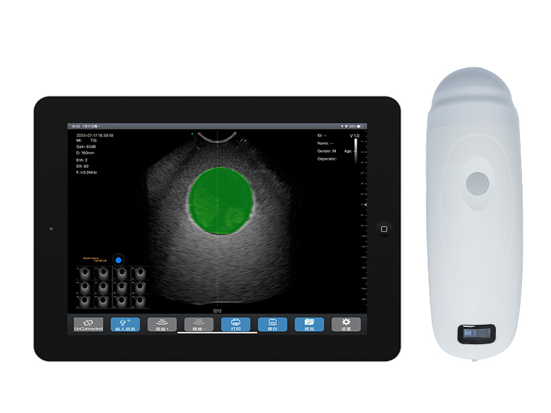 BProbe-5 4D Wireless Bladder Scanner
