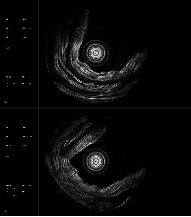 2023112516197622.jpg U1000-9.jpg