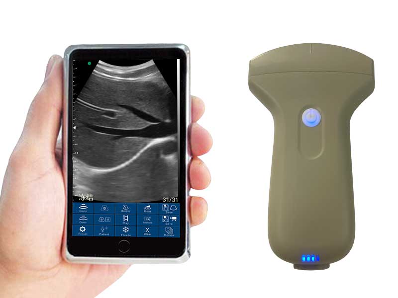3C convex palm doppler ultrasound scanner