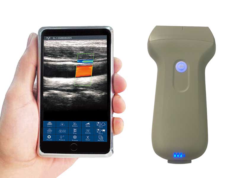 3L linear palm doppler ultrasound scanner