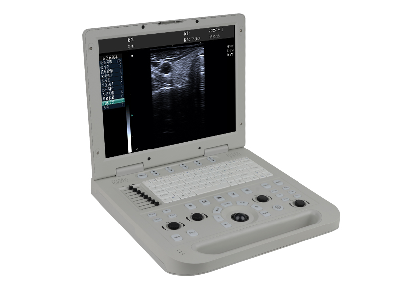SS-10 Full Digital Laptop Ultrasound Scanner