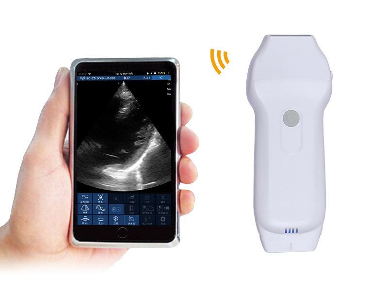 4LPA 2in1 palm doppler ultrasound scanner
