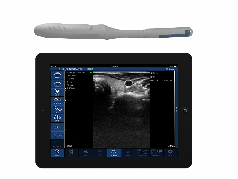 4CR biplane rectal palm doppler ultrasound scanner