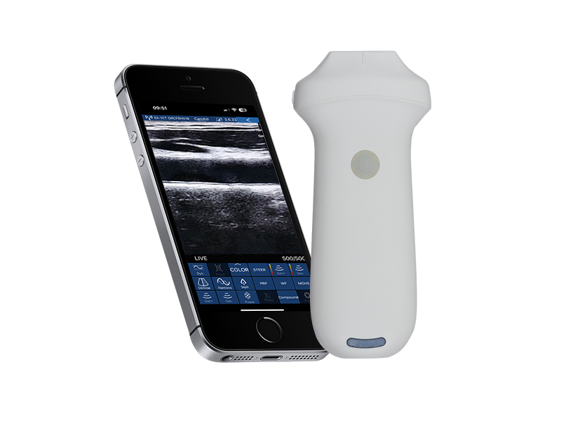 8N linear palm doppler ultrasound scanner
