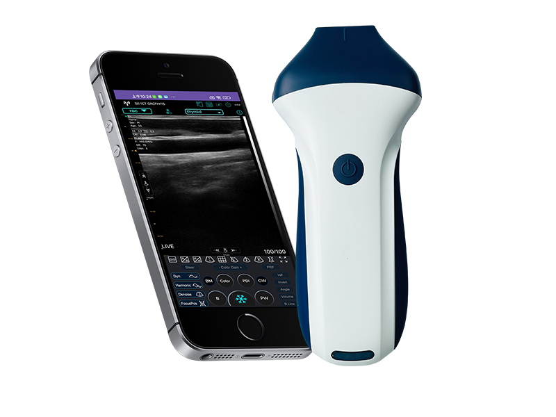 7H linear palm doppler ultrasound scanner(VIP Exclusive)