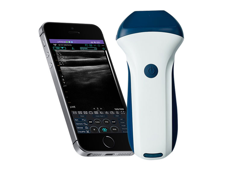 7N linear palm doppler ultrasound scanner