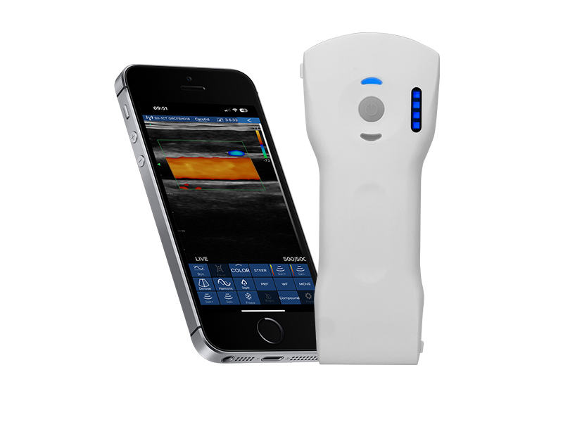 8CPL 3in1 palm doppler ultrasound scanner(VIP Exclusive)