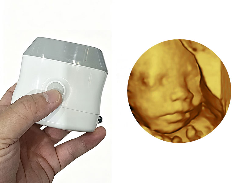 4D Scanning Stereo Imaging Handheld Ultrasound
